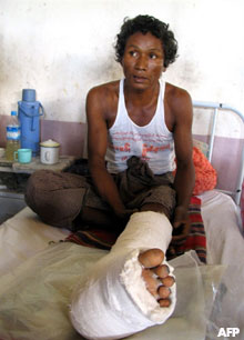 A landmine victim, Than Lwin, sitting in his hospital bed in Mone village, some 160 kilometers north of Rangoon, in a file photo dated 2006. Since then, hundreds of land mine victims have been added to the role of people killed or injured by land mines planted by the Burmese regime or by armed groups in the country. AFP Photo / Hla Hla Htay