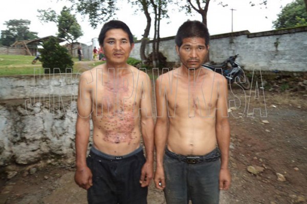 Jau Fa Ying, a Chinese villager of Yi Hku was arrested and tortured by Burmese government troops on July 1.