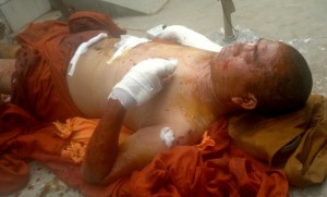 U-Wilar-Thatga-the-injured-Burmese-monk-by-India-bomb-explosion