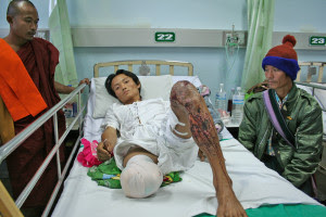 A landmine victim receives treatment at Mae Tao Clinic on the Thai-Burma border (Phil Thornton)