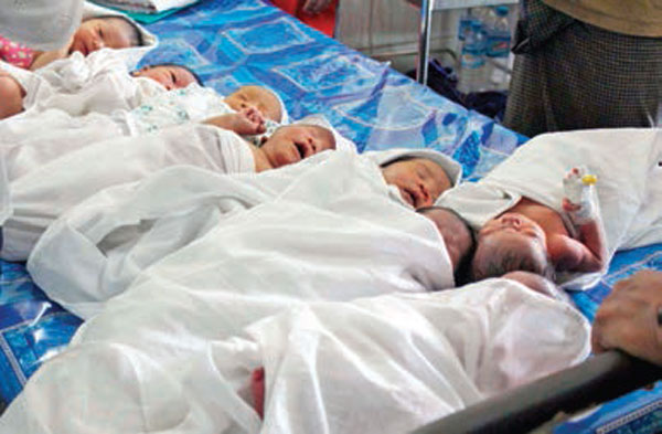 child-jaundice-in-kalay