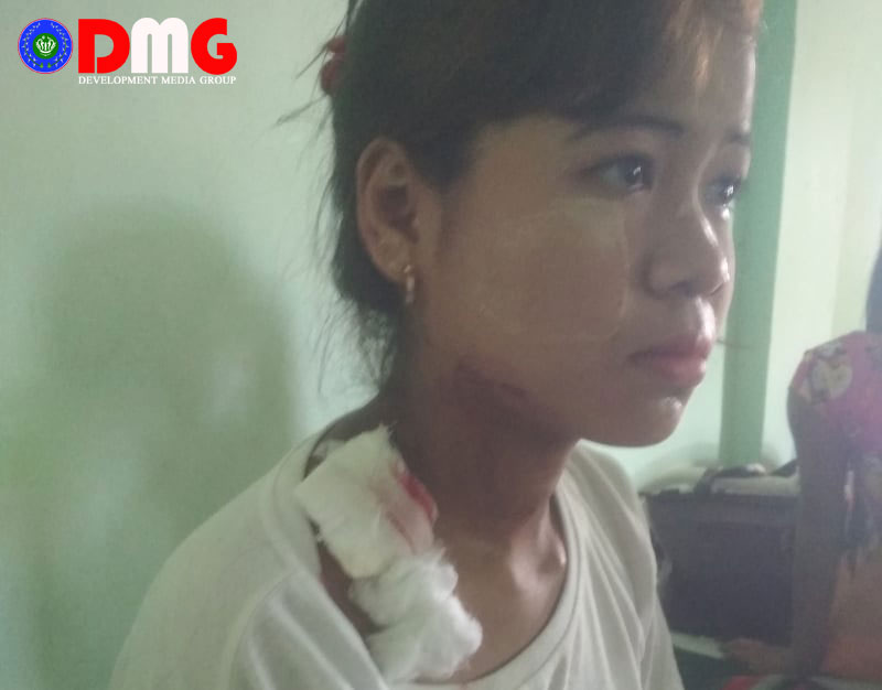 14-year-old Hit By Stray Bullet In Ponnagyun Twsp | Burma News ...