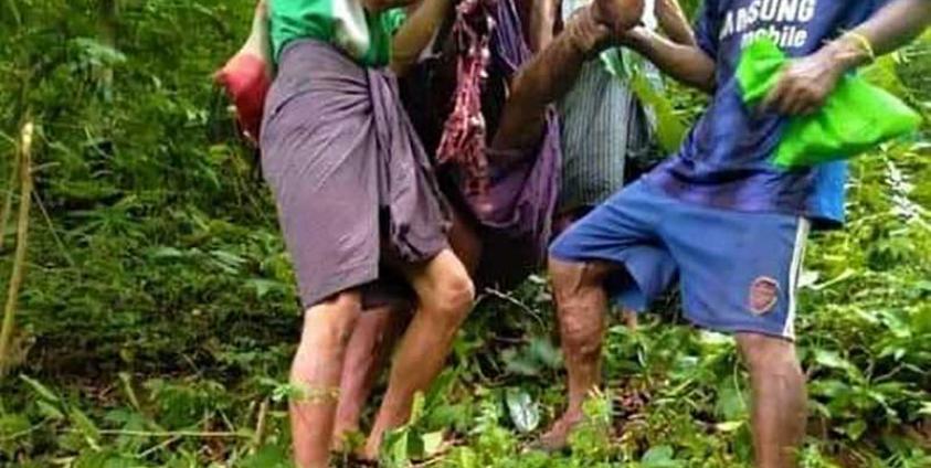 A landmine victim in Minbya Township, Arakan State, was taken to a public hospital on August 5.