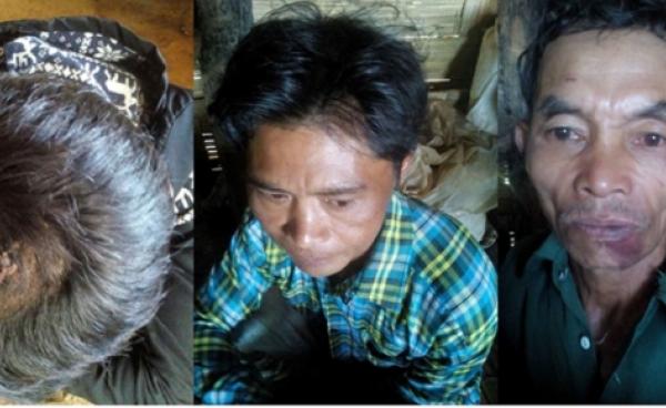 Photo SHRF: three victim villagers who were beaten by Burmese army.